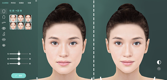 什么是數(shù)字3D整形？